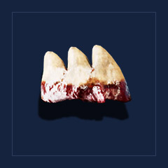 Snapper`s teethTrophy